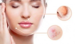 小度痘痘了吃瓜,一场吃瓜引发的美丽蜕变