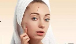 小度痘痘了吃瓜,一场吃瓜引发的美丽蜕变